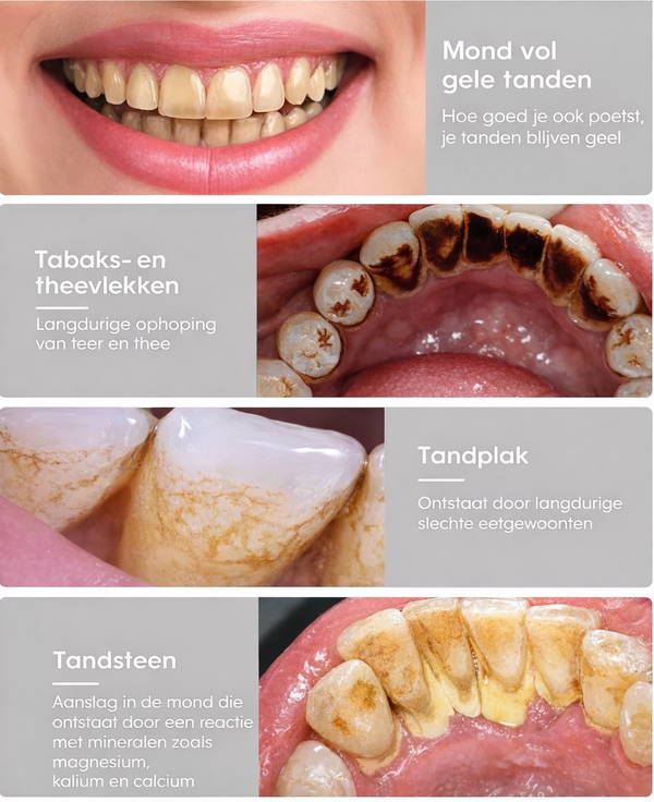 Ultrageluid Tandenreiniger Pro